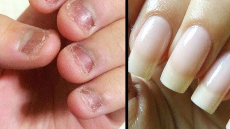 This simple remedy can transform your nails into stunning, strong beauty in days…