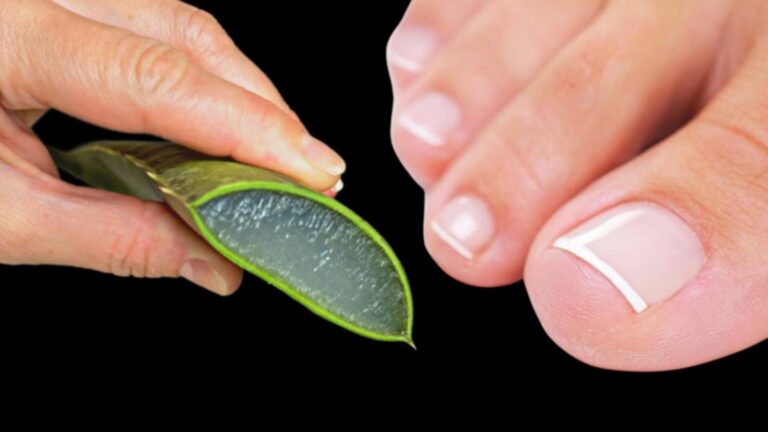 This simple solution reveals how to banish nail fungus using just four ingredients…