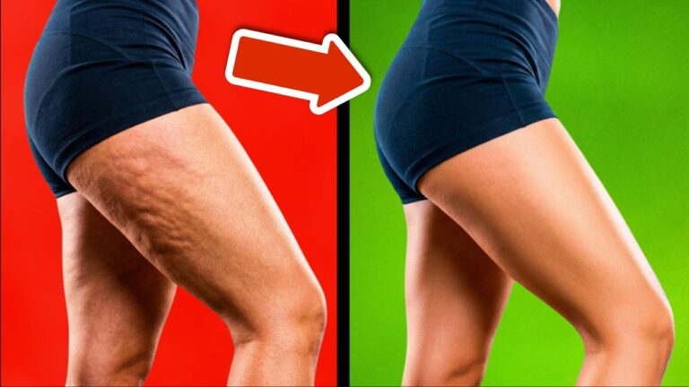 5 Secrets to Rapidly Remove Cellulite and Stretch Marks You Need to Know!