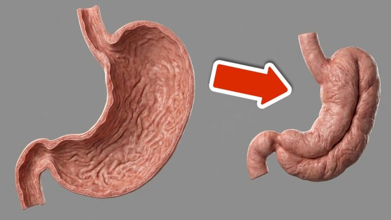 Shrink Your Stomach Fast: 5 Simple Tricks To Try Today!