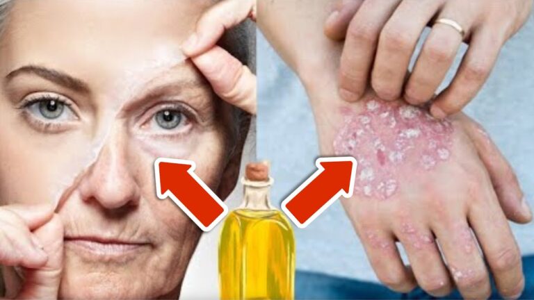 Say Goodbye to 5 Types of Wrinkles with This Simple Oil for Radiant Skin!