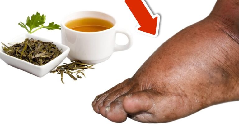 7 Teas to Reduce Swollen Legs and Ankles Naturally – Try One Today!