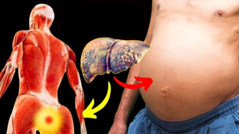 10 Signs Your Liver is Sick That Almost Nobody Knows – Discover the Hidden Risks!