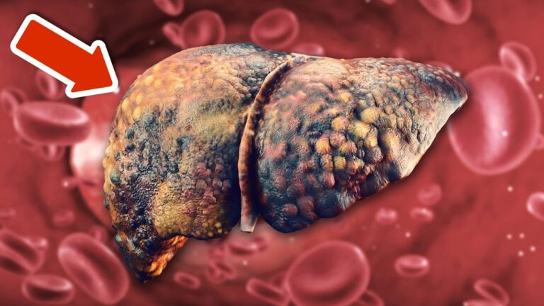 Discover 6 Secret Foods to Naturally Detox Your Liver Today!