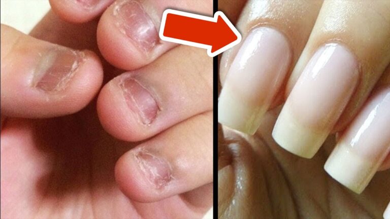 Get Gorgeous Nails in Just 7 Days with This Secret Trick! 💅✨