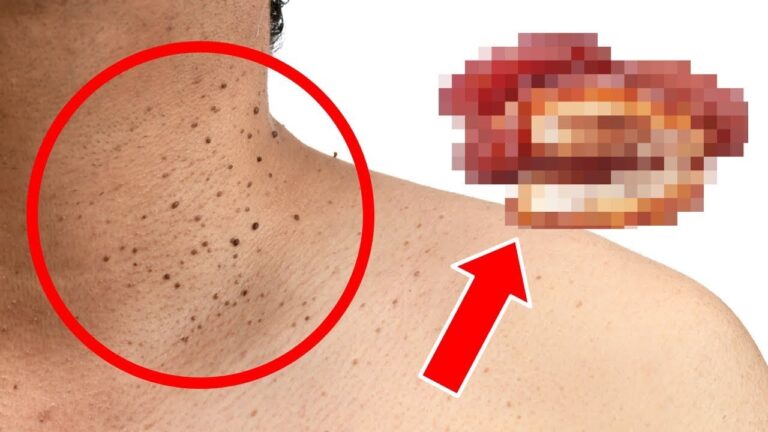 Discover 7 Common Foods Secretly Causing Your Hair Loss