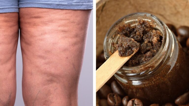 Say Goodbye to Cellulite and Stretch Marks with This DIY Coffee Scrub