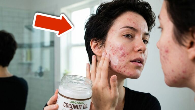5 Shocking Reasons You Should Never Use Coconut Oil on Your Face!