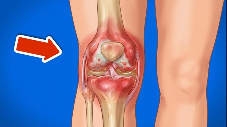 Discover 5 Surprising Reasons Your Joints Won’t Heal and How to Fix Them!